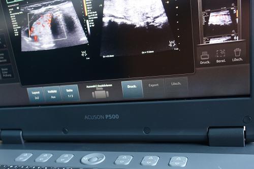 Ultraschall